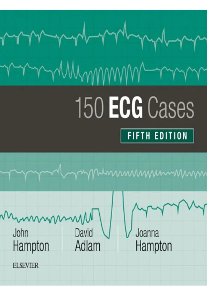 150 ECG Cases Book by David Adlam