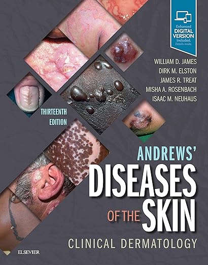 Andrews' Diseases of the Skin: Clinical Dermatology 13th Edition by William D. James MD