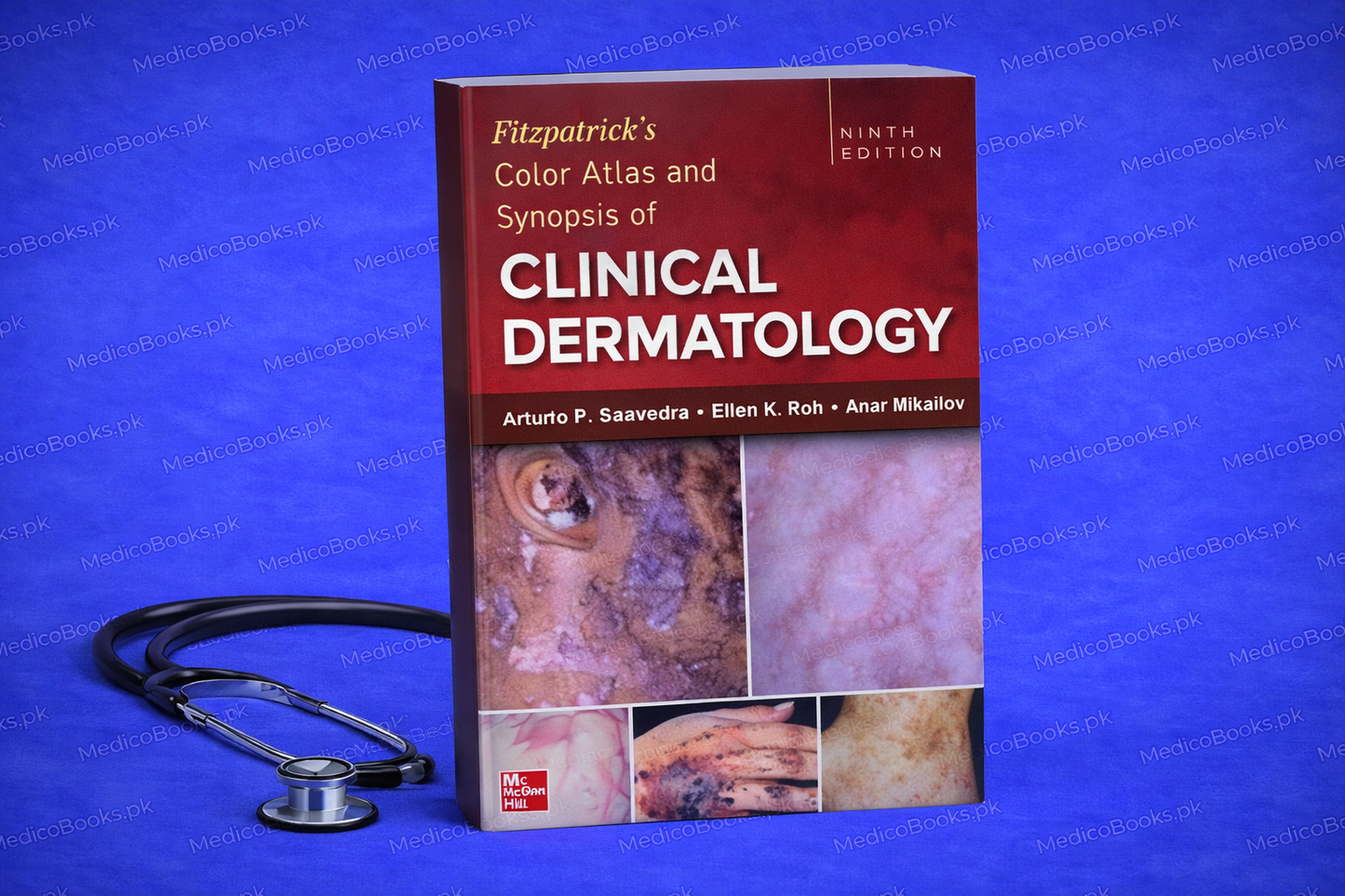 Fitzpatrick's Color Atlas and Synopsis of Clinical Dermatology, Ninth Edition by Arturo P. Saavedra