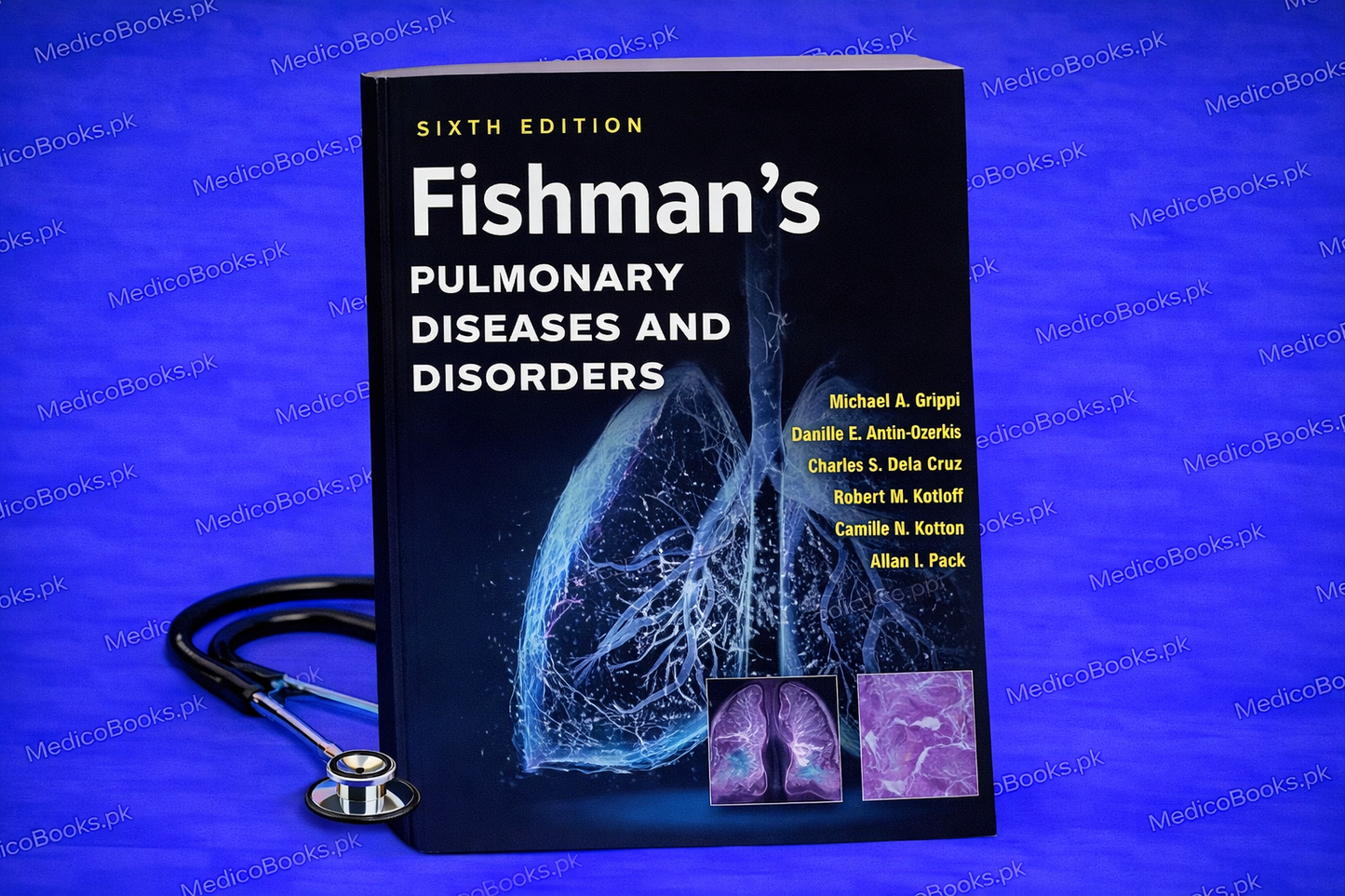 Fishman's Pulmonary Diseases and Disorders, 4-Volume Set,6th Edition by Michael A. Grippi