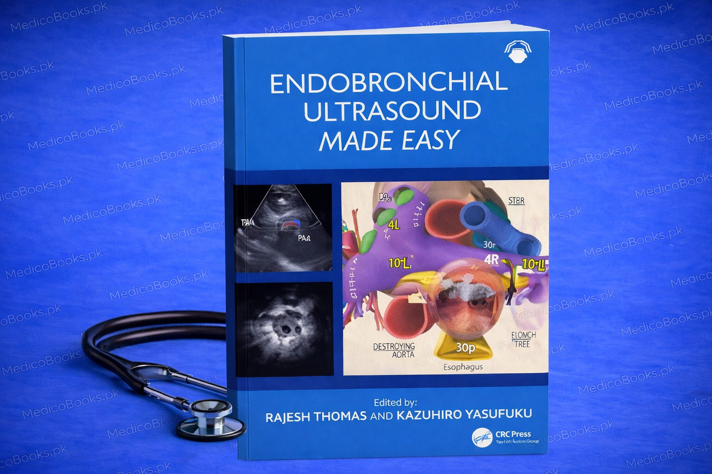 Endobronchial Ultrasound Made Easy: Made Easy 1st Edition by Rajesh Thomas