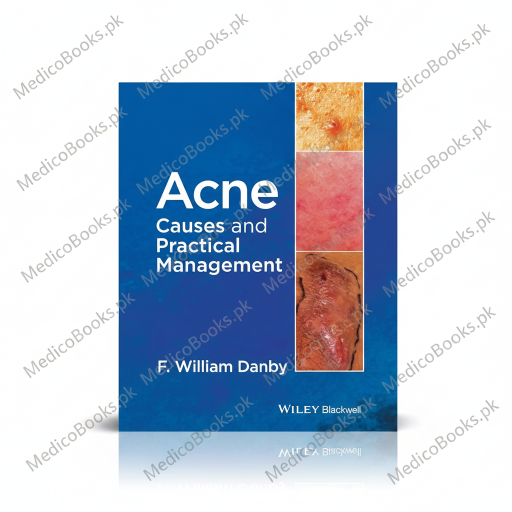 Acne: Causes and Practical Management F William Danby