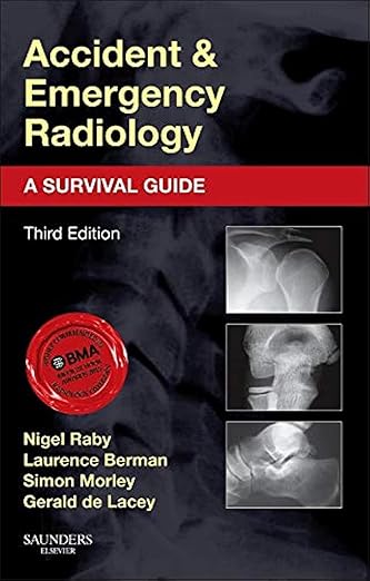 Accident and Emergency Radiology: A Survival Guide 3rd Edition by Nigel Raby FRCR