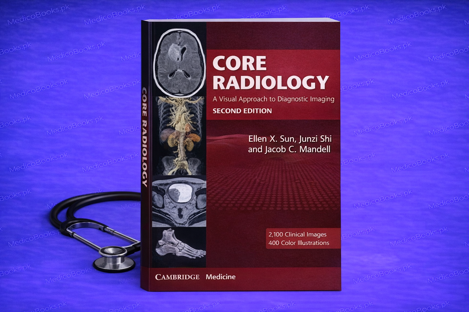 Core Radiology 2nd Edition by Ellen X. Sun | MedicoBooks.pk