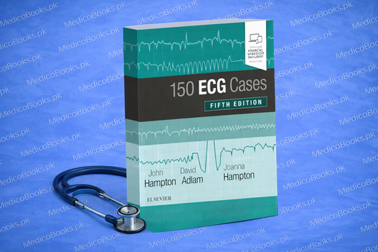 150 ECG Cases Book by David Adlam
