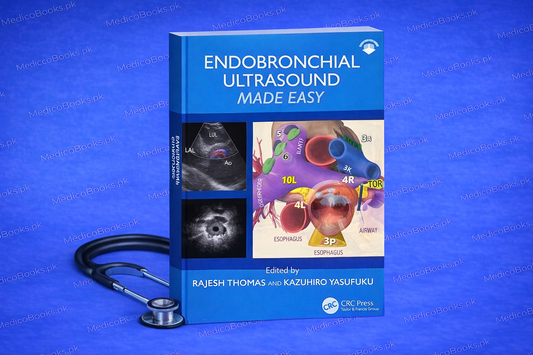 Endobronchial Ultrasound Made Easy: Made Easy – 31 July 2025 by Rajesh Thomas