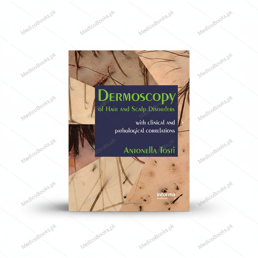 Dermoscopy of Hair and Scalp Disorders: With Clinical and Pathological Correlations by Antonella Tosti