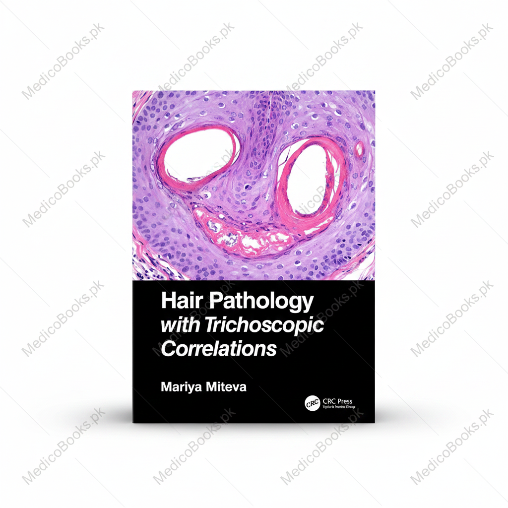 Hair Pathology with Trichoscopic Correlations by Mariya Miteva
