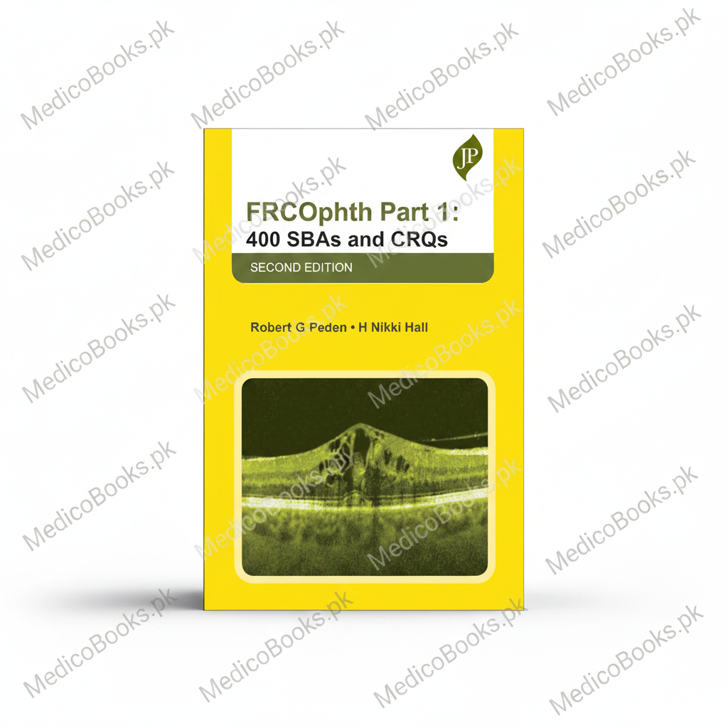 FRCOphth Part 1: 400 SBAs and CRQs by Robert G Peden